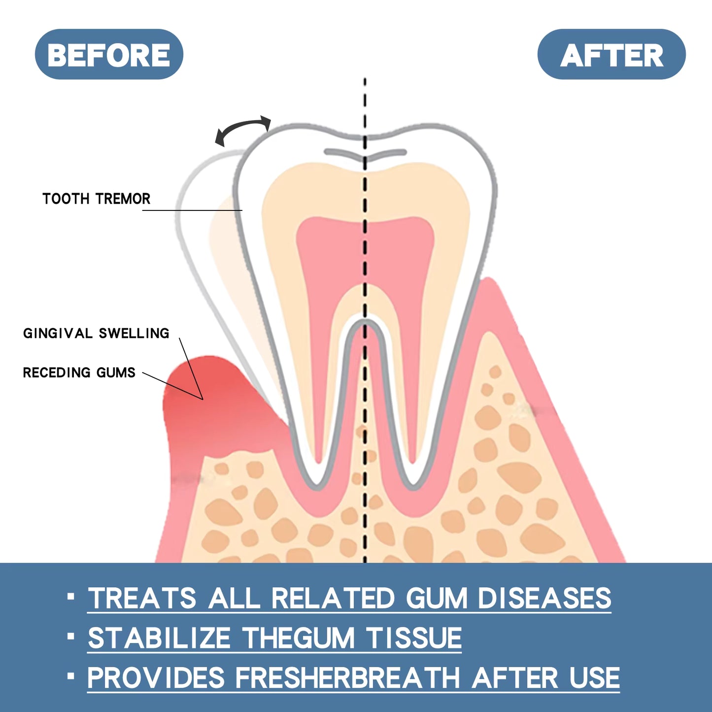 Rapid Repair Gum Serum