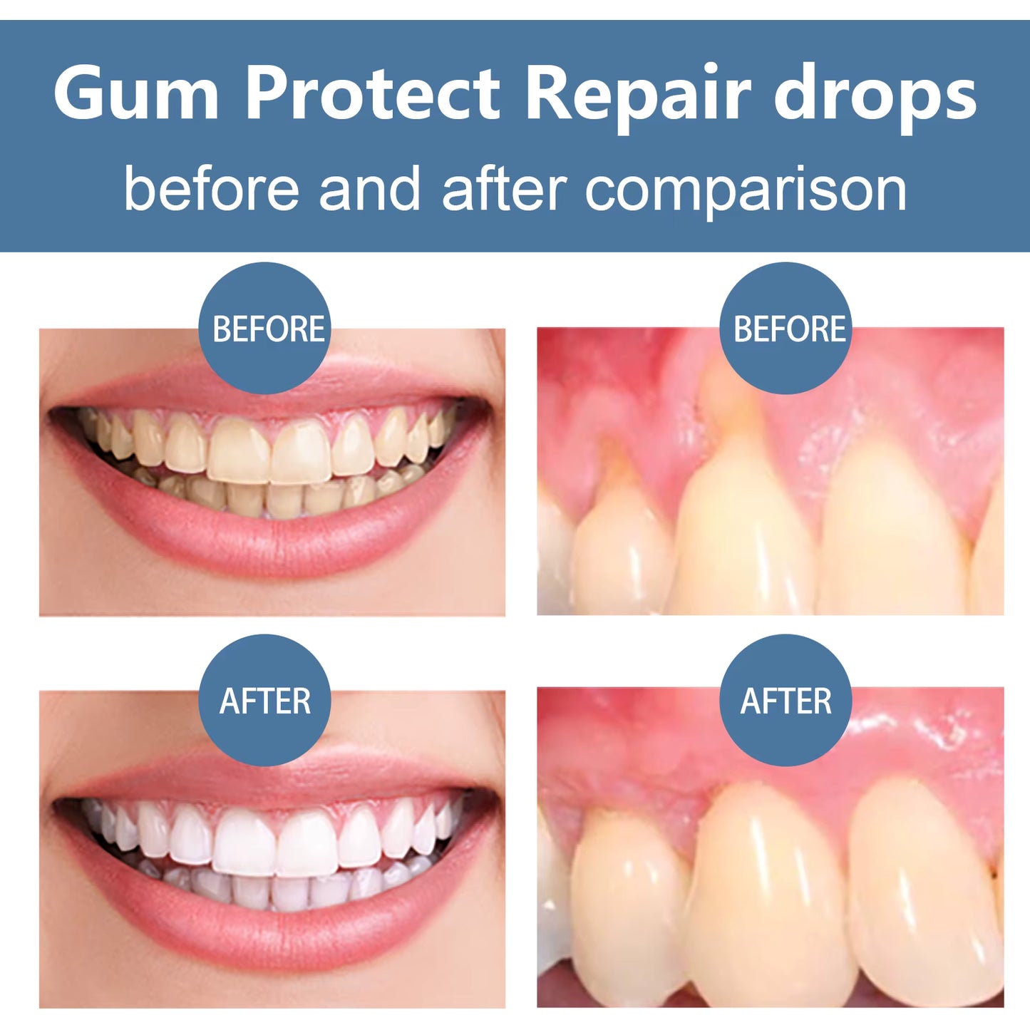 Rapid Repair Gum Serum