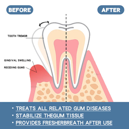 Rapid Repair Gum Serum